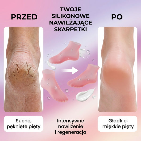 AquaStopki - silikonowe skarpetki do pielęgnacji stóp
